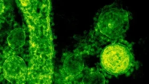 Legionnaires' disease hotspots map: Third person dies in NYC as 74 cases identified;