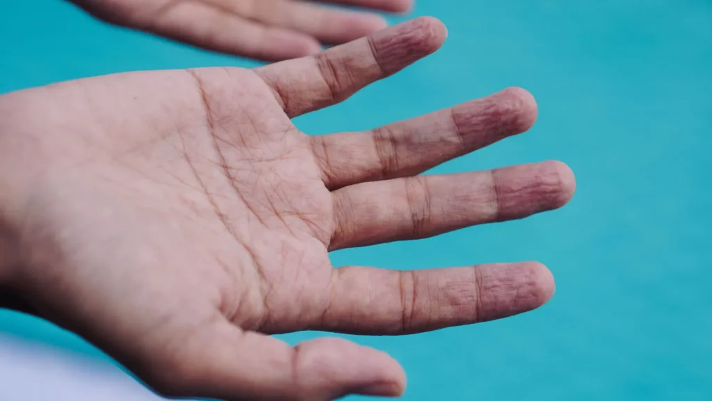 Why it matters: Everyday explained: Why do your fingers wrinkle: A practical reader guide