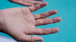 Why it matters: Everyday explained: Why do your fingers wrinkle: A practical reader guide