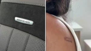Mercedes driver alleges she had 'half metallic AMG logo burned onto her skin', sues