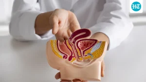 Why more young adults are being diagnosed with colon cancer: Oncologist Dr Ravi K