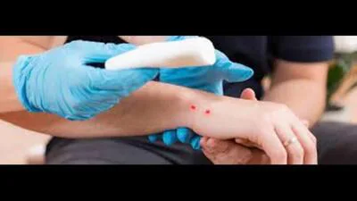 Young siblings die of snakebite — Raksha Bandhan turns tragic: A practical reader guide