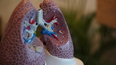 World Lung Cancer Day 2026: Can the kitchen harm your lungs? Oncologist Dr Ravi