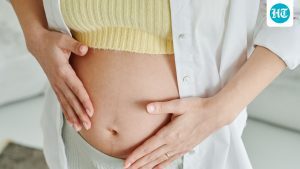 Conditions and treatment briefing: Pregnancy skin changes: Dermatologist shares 7 common signs that usually