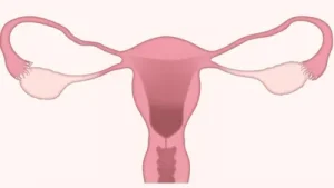 September is recognized as PCOS Awareness Month, now also widely: A practical reader guide