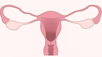 September is recognized as PCOS Awareness Month, now also widely: A practical reader guide
