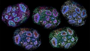 Supreme Court lens on stem cell therapy for autism: A practical reader guide