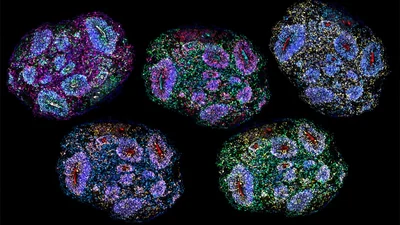 Supreme Court lens on stem cell therapy for autism: A practical reader guide