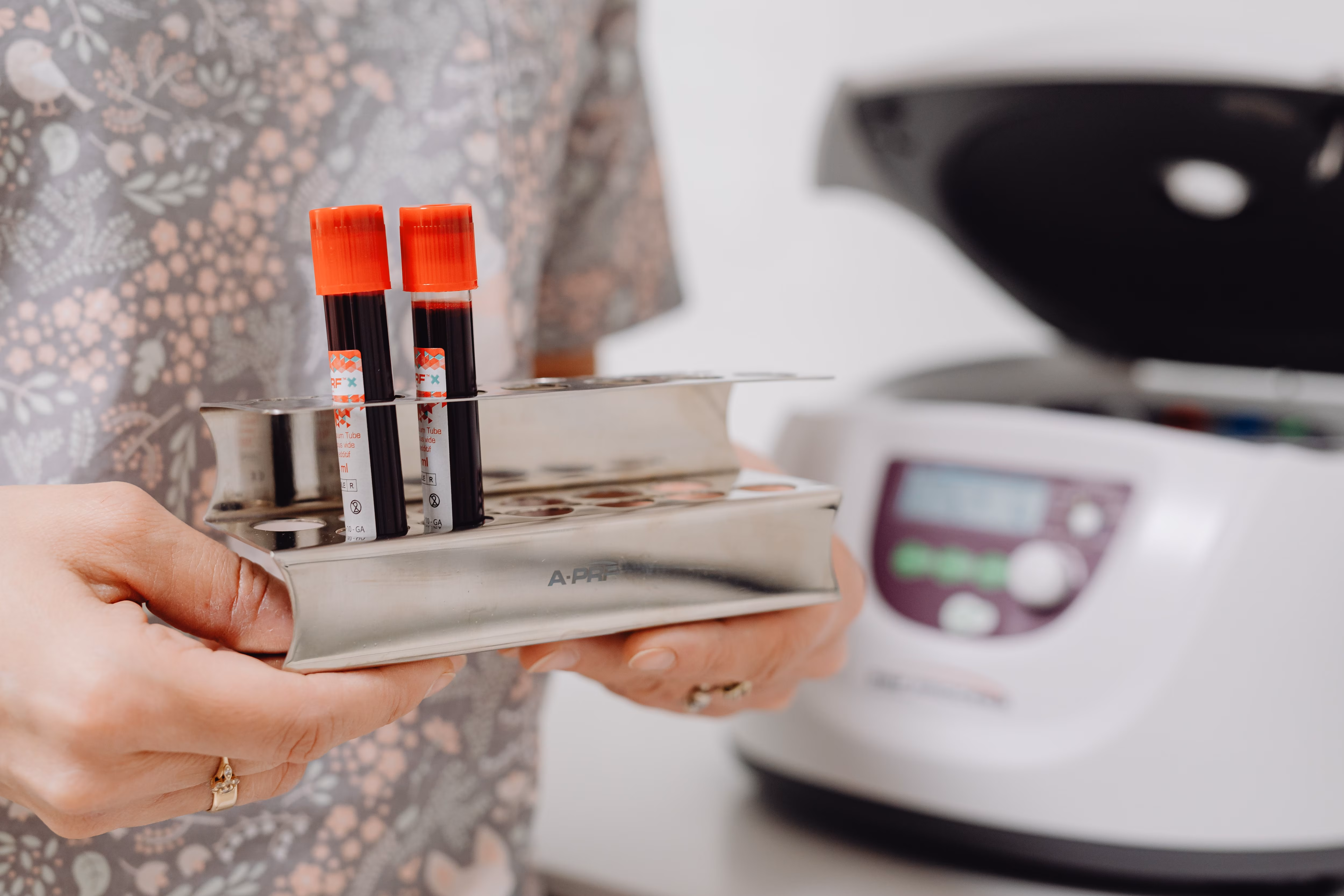 Can a blood test detect cancer? Here are the tests oncologist: A practical reader guide