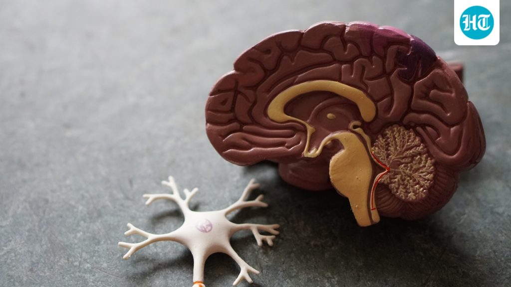 Therefore, a poor score on a memory test does not confirm Alzheimer's: A practical reader guide