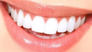 “Enamel erosion contributes to many common dental issues, serving as: A practical reader guide