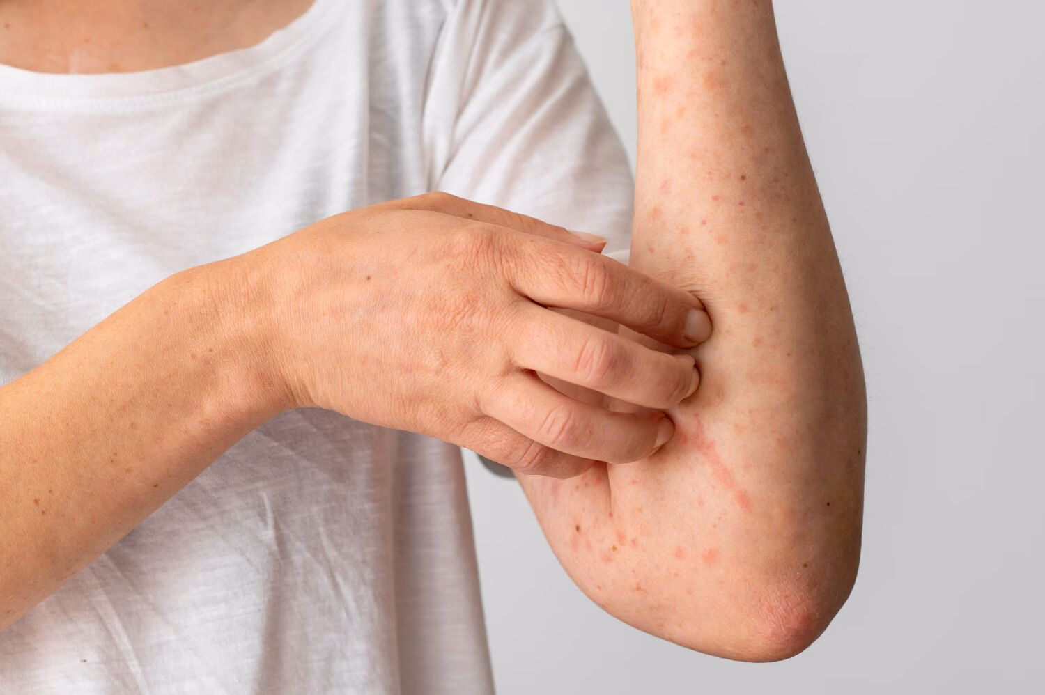 Viral infections are among the common causes of skin rashes: A practical reader guide
