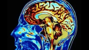 Is your forgetfulness a red flag? Neurologist raises concerns over: A practical reader guide