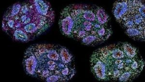 Supreme Court orders autism patients on stem cell therapy to register: A practical reader guide