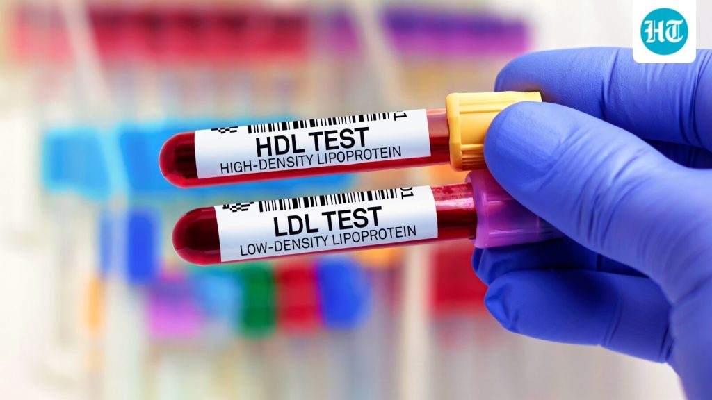 You can have a healthy-looking body and still have high cholesterol: A practical reader guide