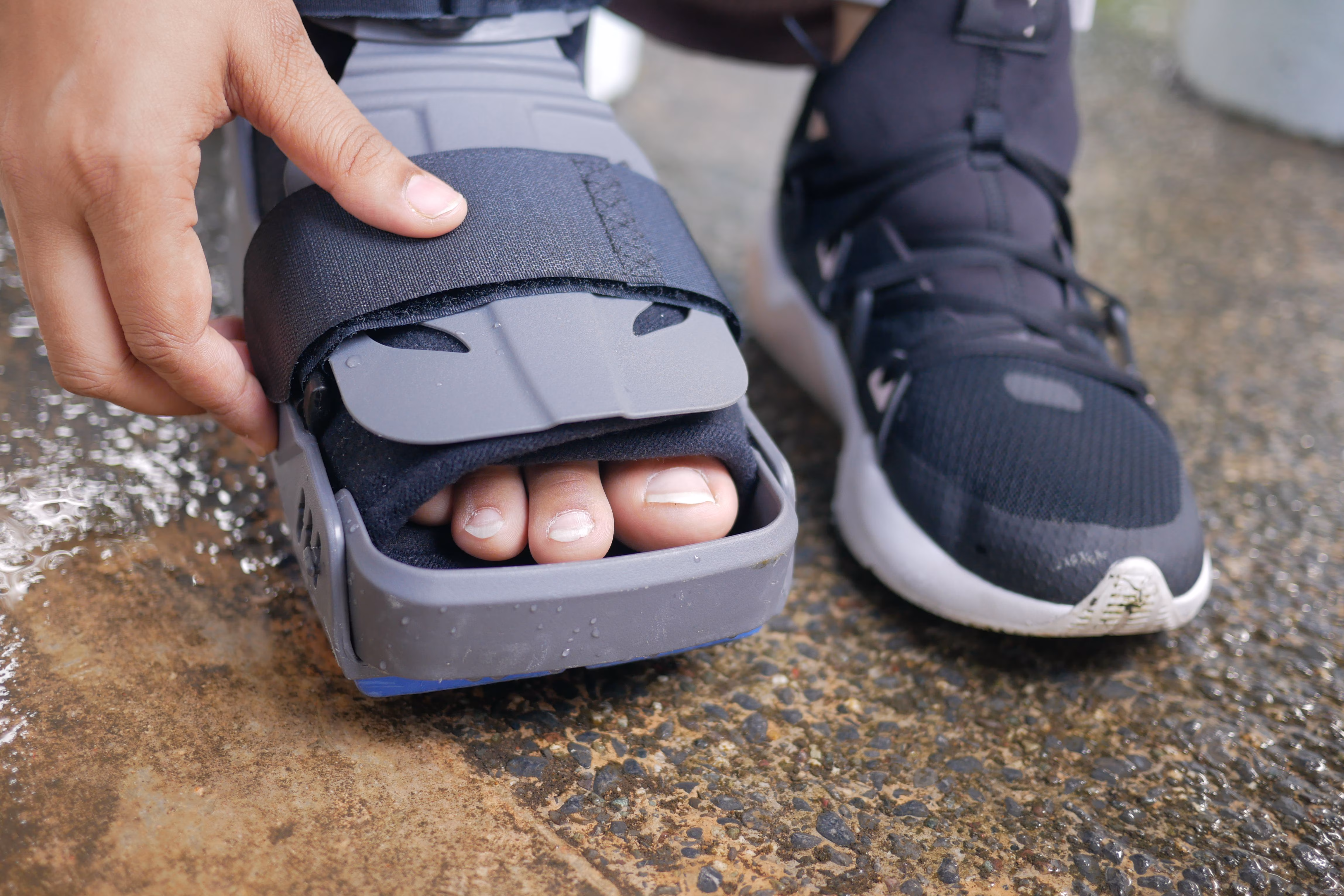 Clinical researcher explains the effect of diabetes on foot health: A practical reader guide