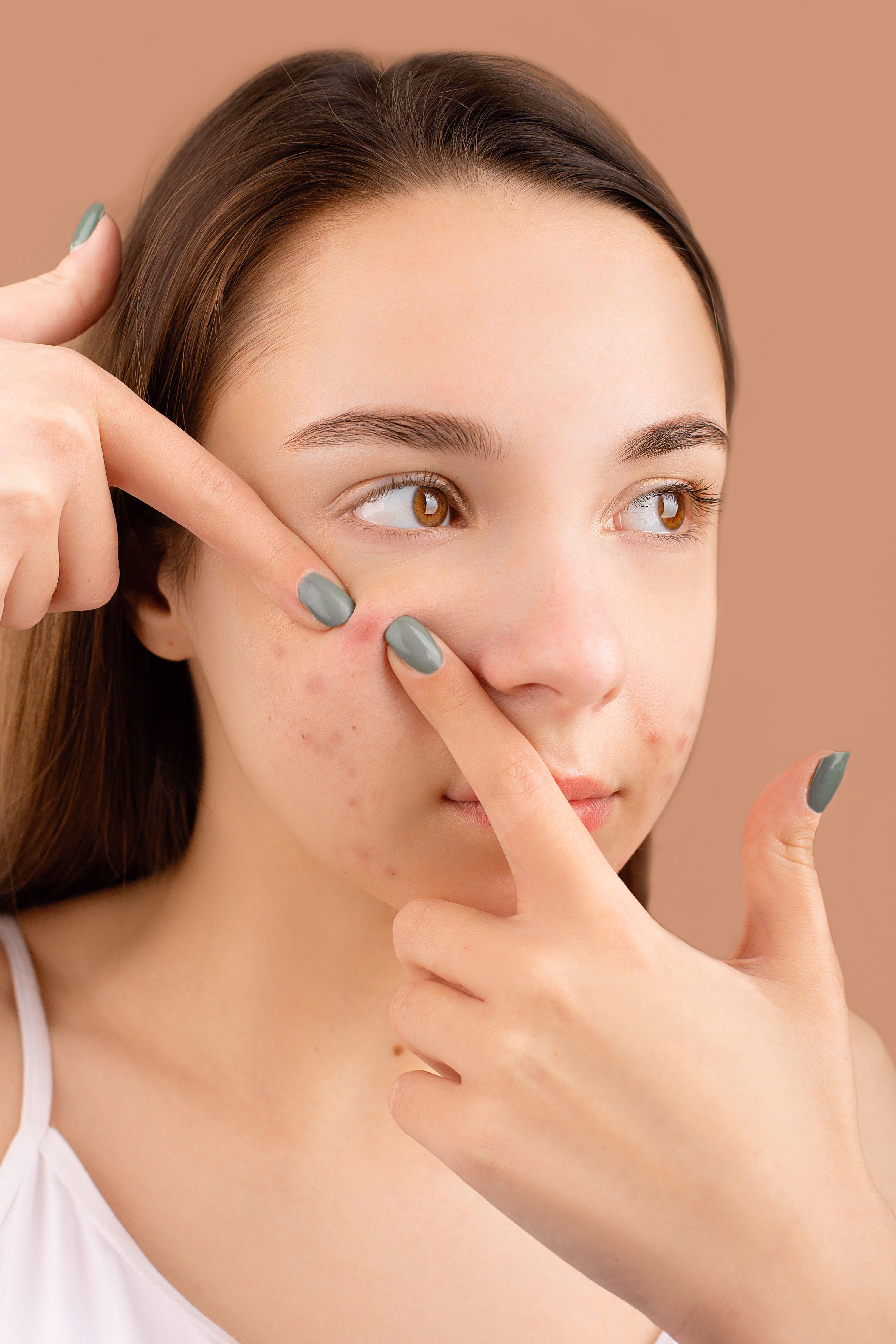 Dermatologist explains what your acne patterns may reveal about your: A practical reader guide