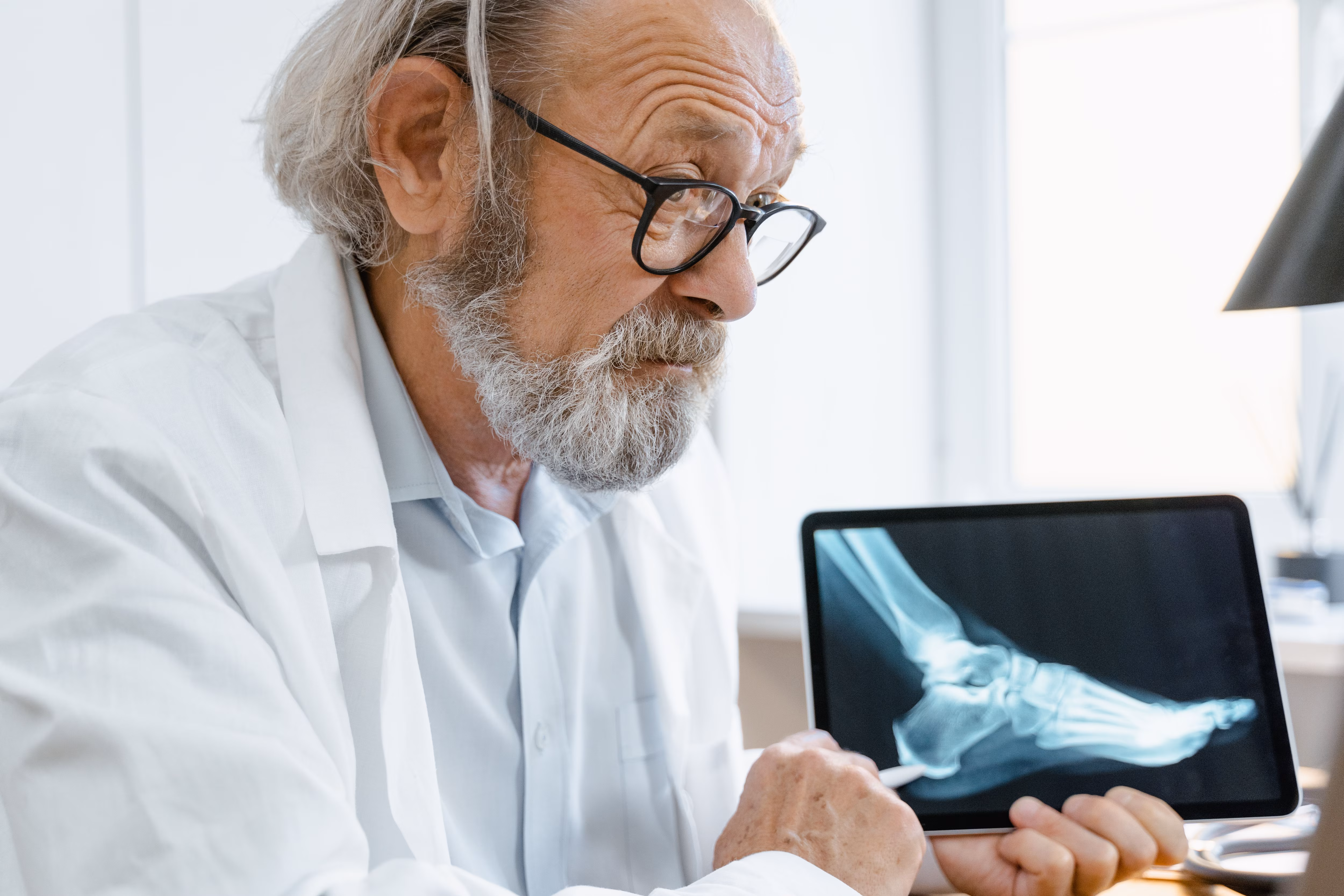 Bones can lose strength for years without a single symptom: A practical reader guide